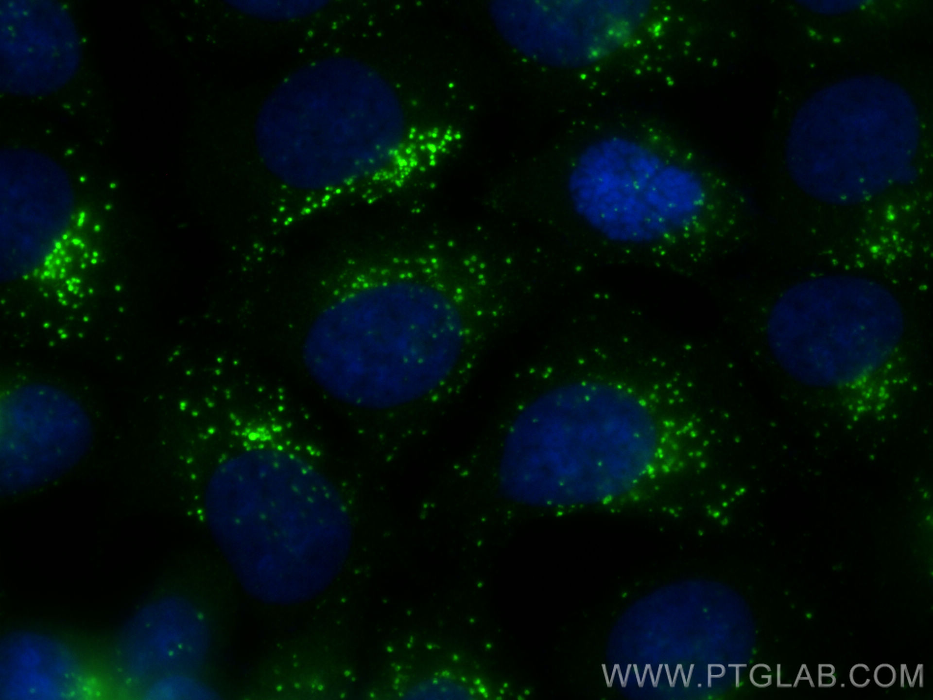 Immunofluorescence (IF) / fluorescent staining of MCF-7 cells using Cathepsin D Polyclonal antibody (21327-1-AP)