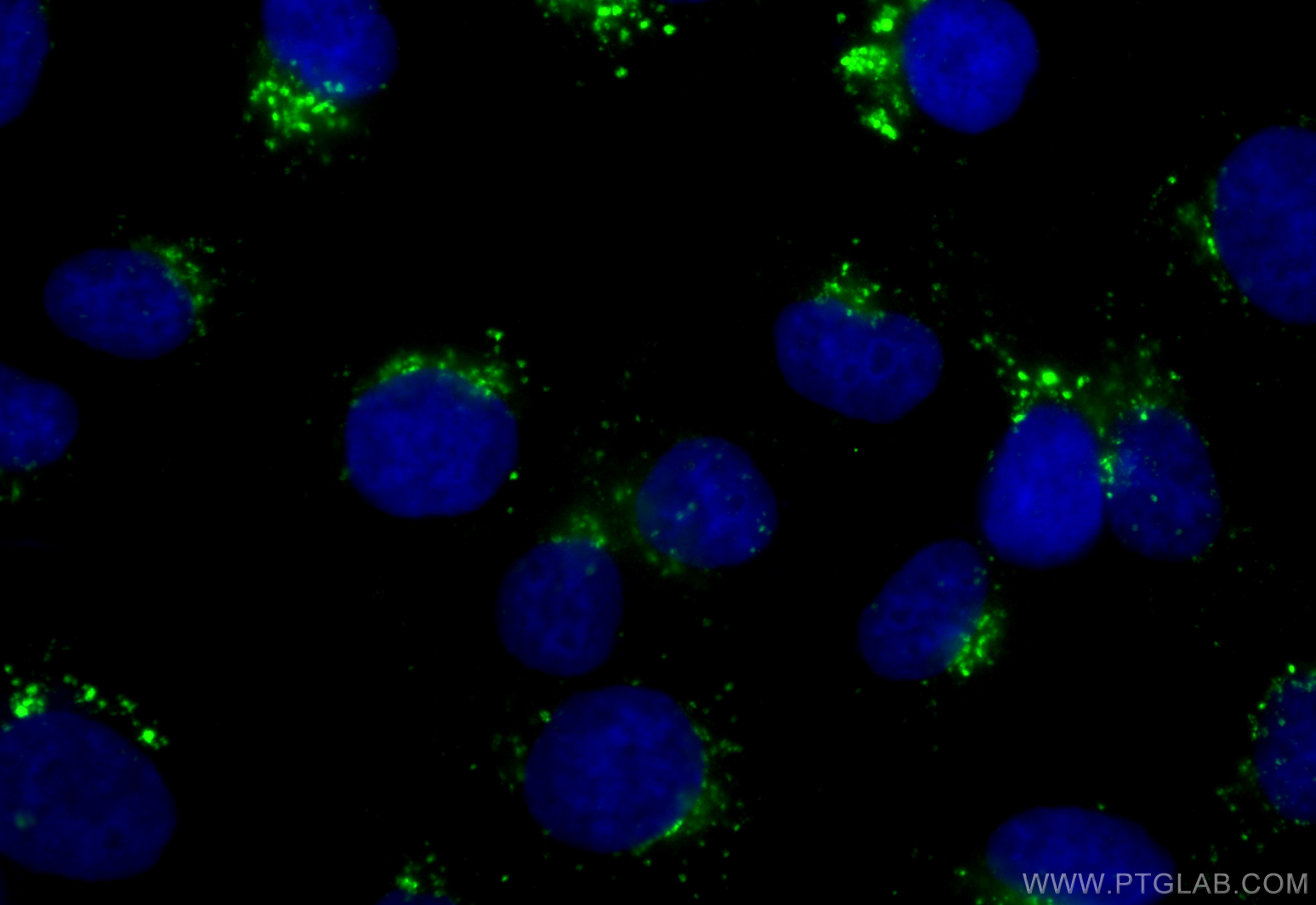 Immunofluorescence (IF) / fluorescent staining of A431 cells using Cathepsin D Polyclonal antibody (21327-1-AP)