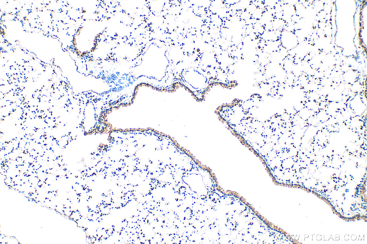 Immunohistochemistry (IHC) staining of mouse lung tissue using Cathepsin H Polyclonal antibody (10315-1-AP)