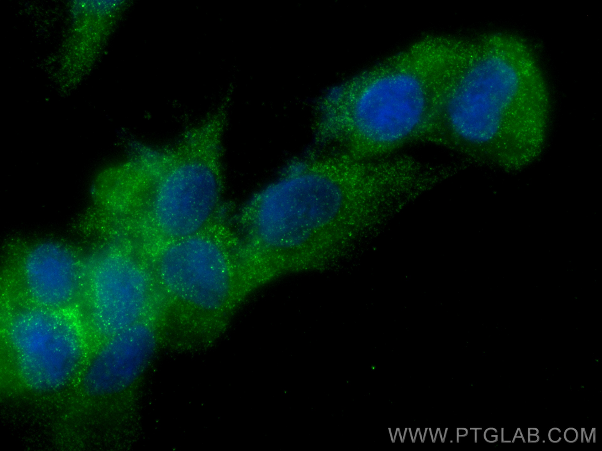 Immunofluorescence (IF) / fluorescent staining of ROS1728 cells using Cathepsin K Polyclonal antibody (11239-1-AP)