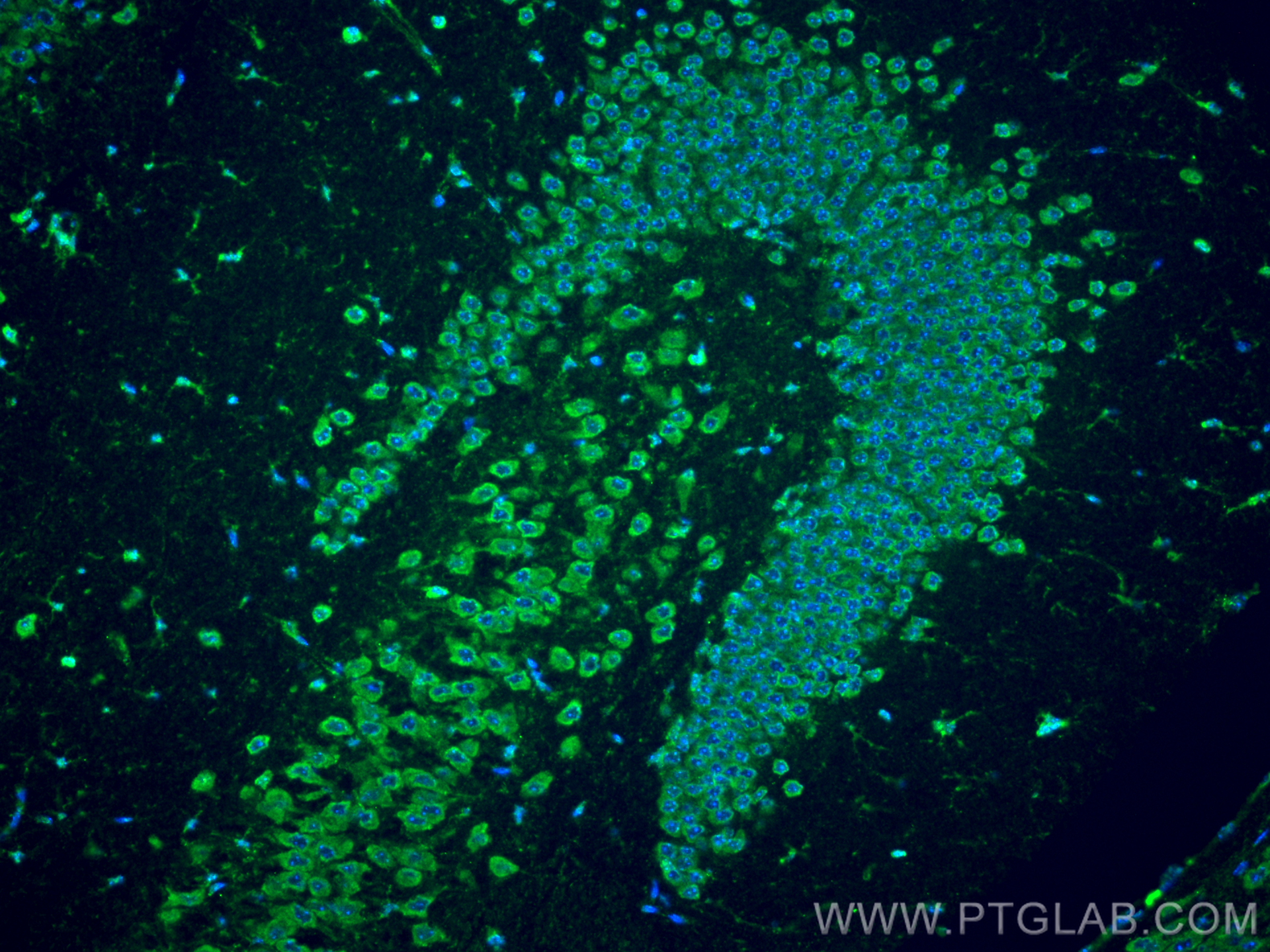 Immunofluorescence (IF) / fluorescent staining of mouse brain tissue using Cathepsin K Polyclonal antibody (11239-1-AP)