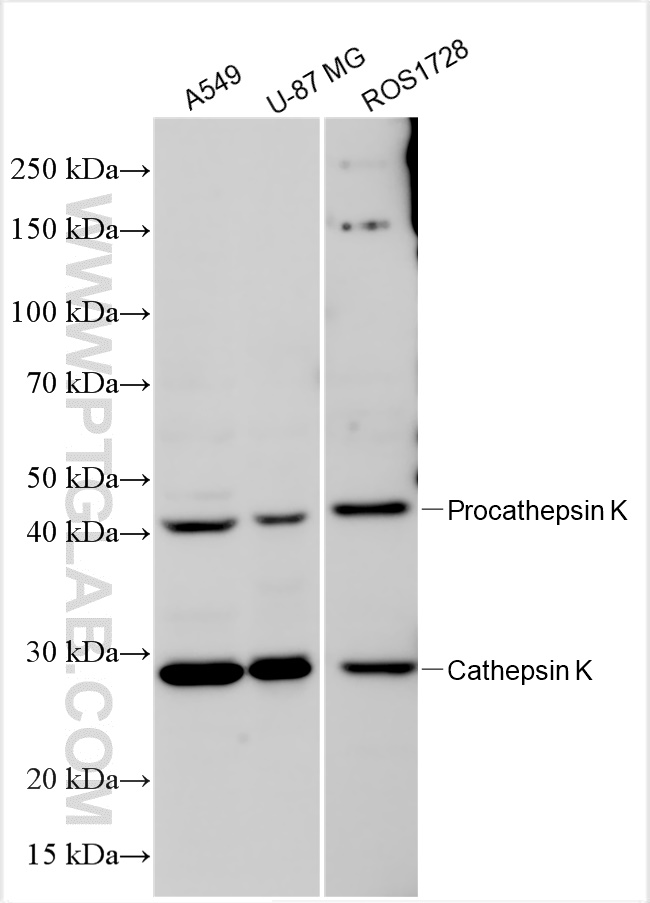 Western Blot (WB) analysis of various lysates using Cathepsin K Polyclonal antibody (11239-1-AP)