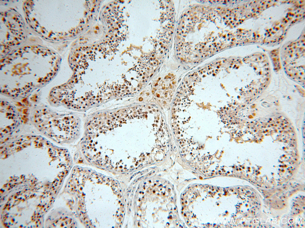 Cathepsin V