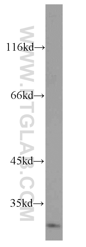 Western Blot (WB) analysis of mouse testis tissue using Cathepsin V Polyclonal antibody (18442-1-AP)