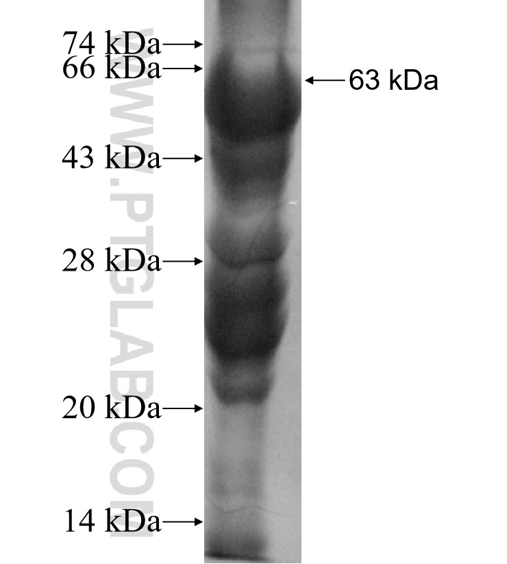 CTSL2 fusion protein Ag13284 SDS-PAGE