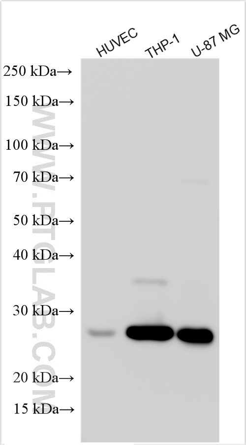 Western Blot (WB) analysis of various lysates using CTSS Polyclonal antibody (27538-1-AP)