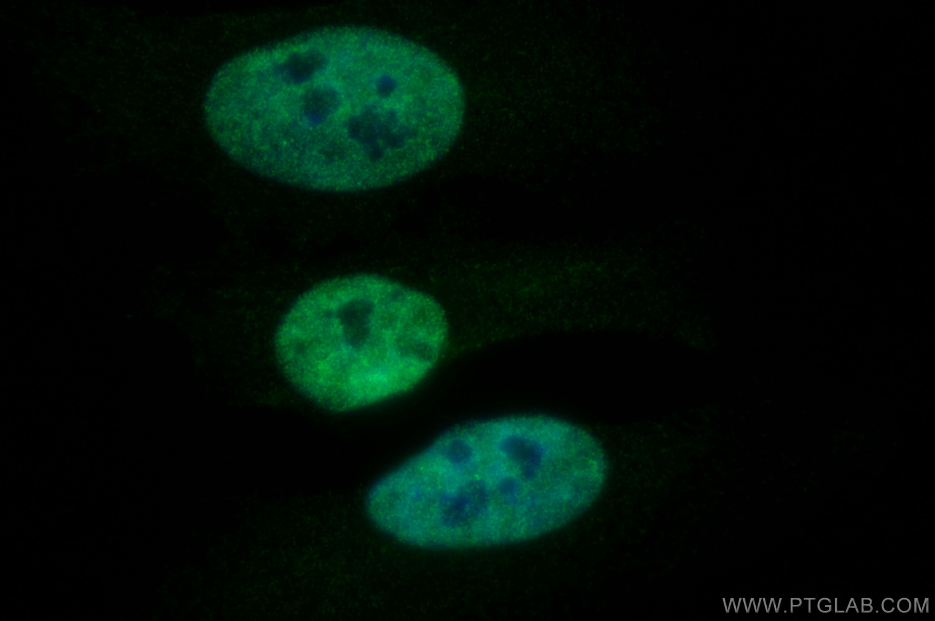 Immunofluorescence (IF) / fluorescent staining of HeLa cells using CUGBP1 Polyclonal antibody (13002-1-AP)