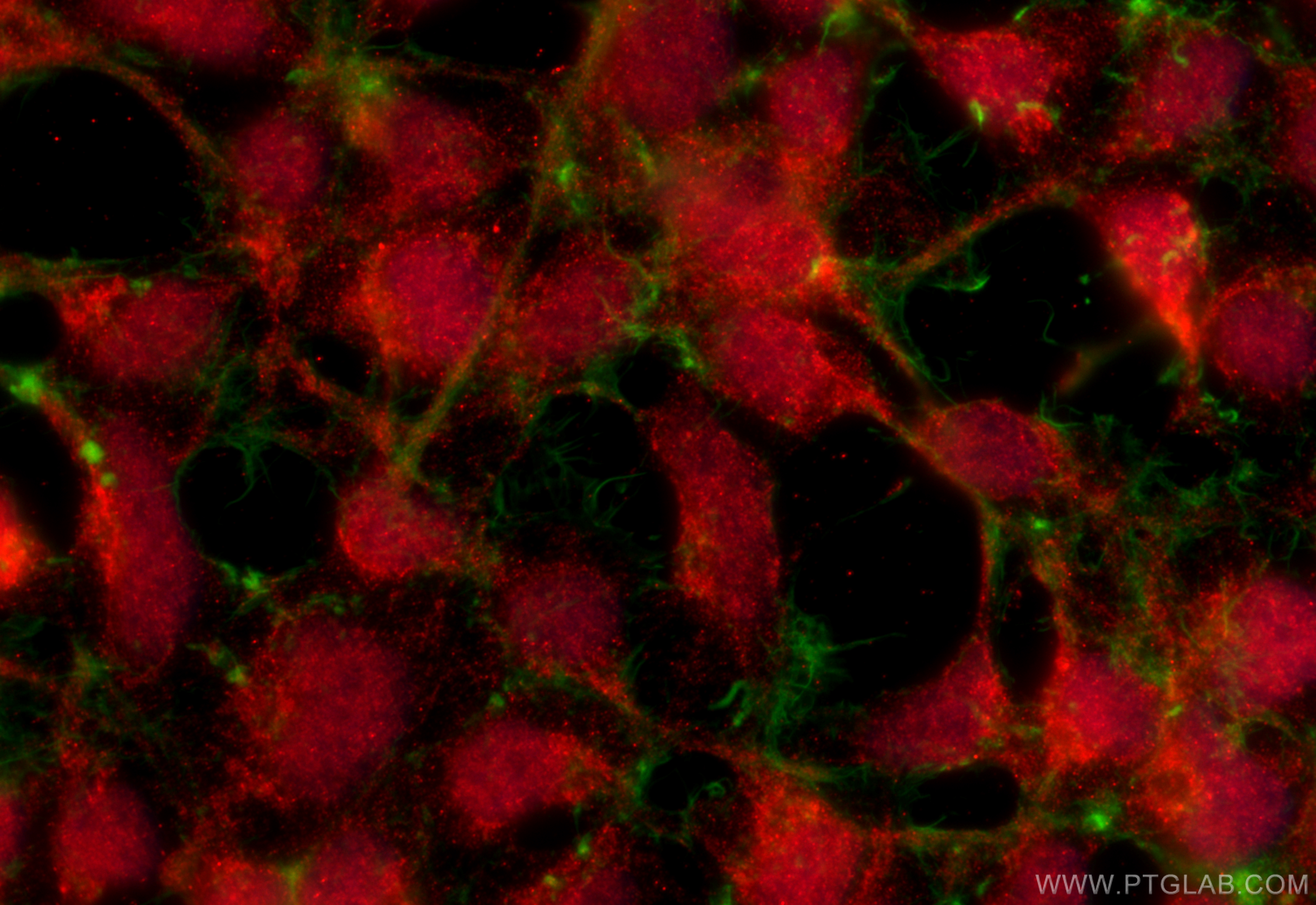 Immunofluorescence (IF) / fluorescent staining of HEK-293 cells using CUL3 Polyclonal antibody (11107-1-AP)