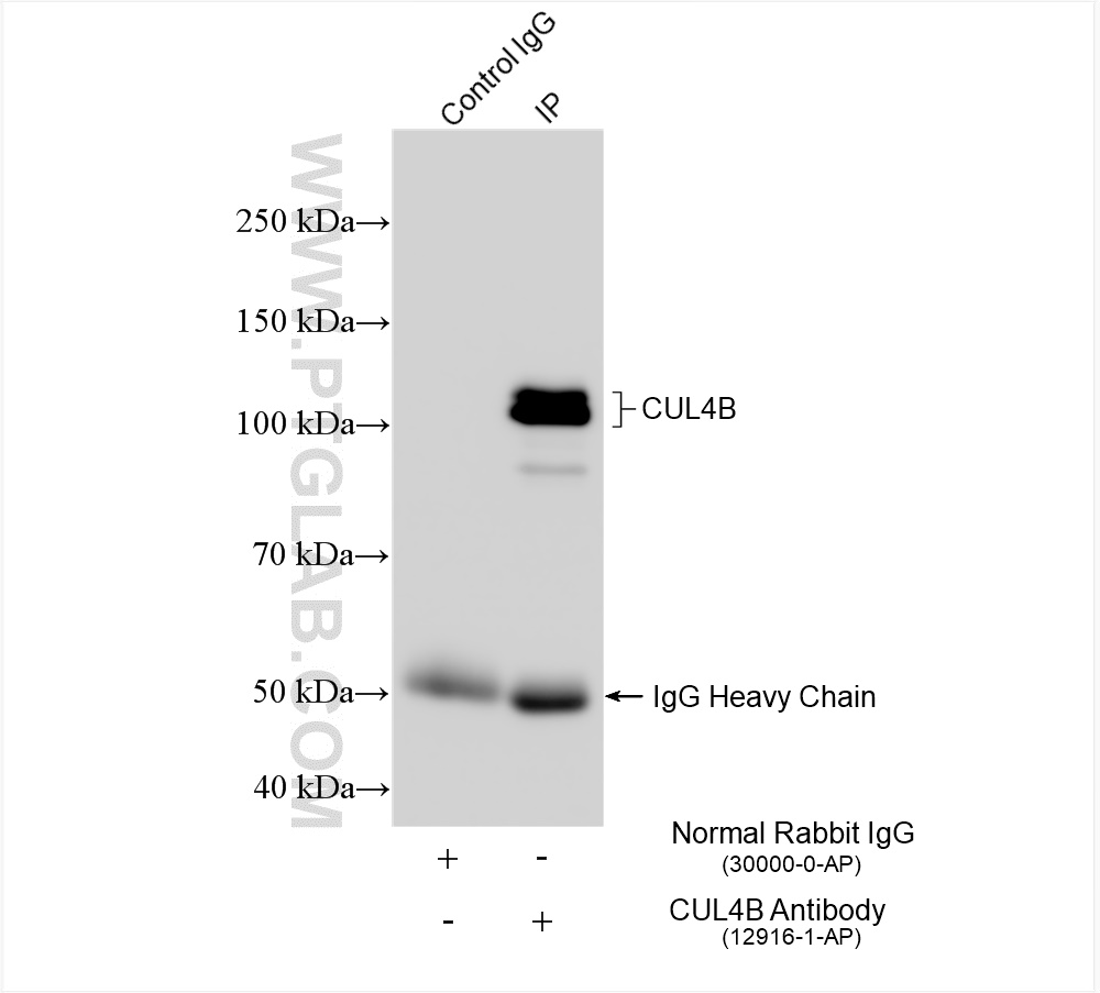 Immunoprecipitation (IP) experiment of HeLa cells using CUL4B Polyclonal antibody (12916-1-AP)