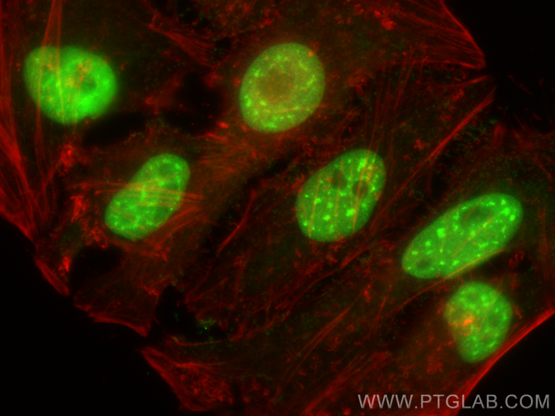 Immunofluorescence (IF) / fluorescent staining of HeLa cells using CUL4B Polyclonal antibody (20882-1-AP)