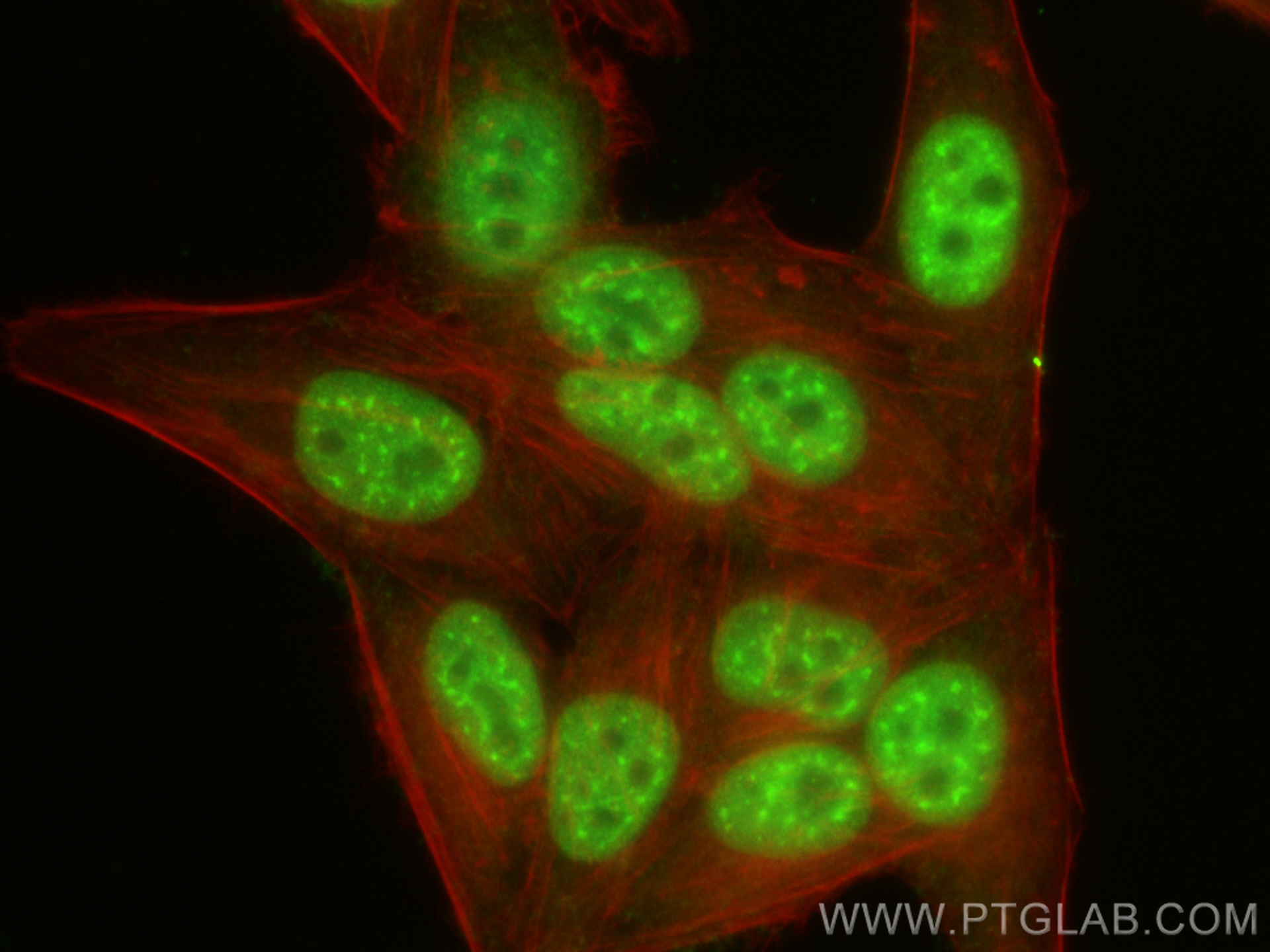 Immunofluorescence (IF) / fluorescent staining of HepG2 cells using CUL4B Polyclonal antibody (20882-1-AP)