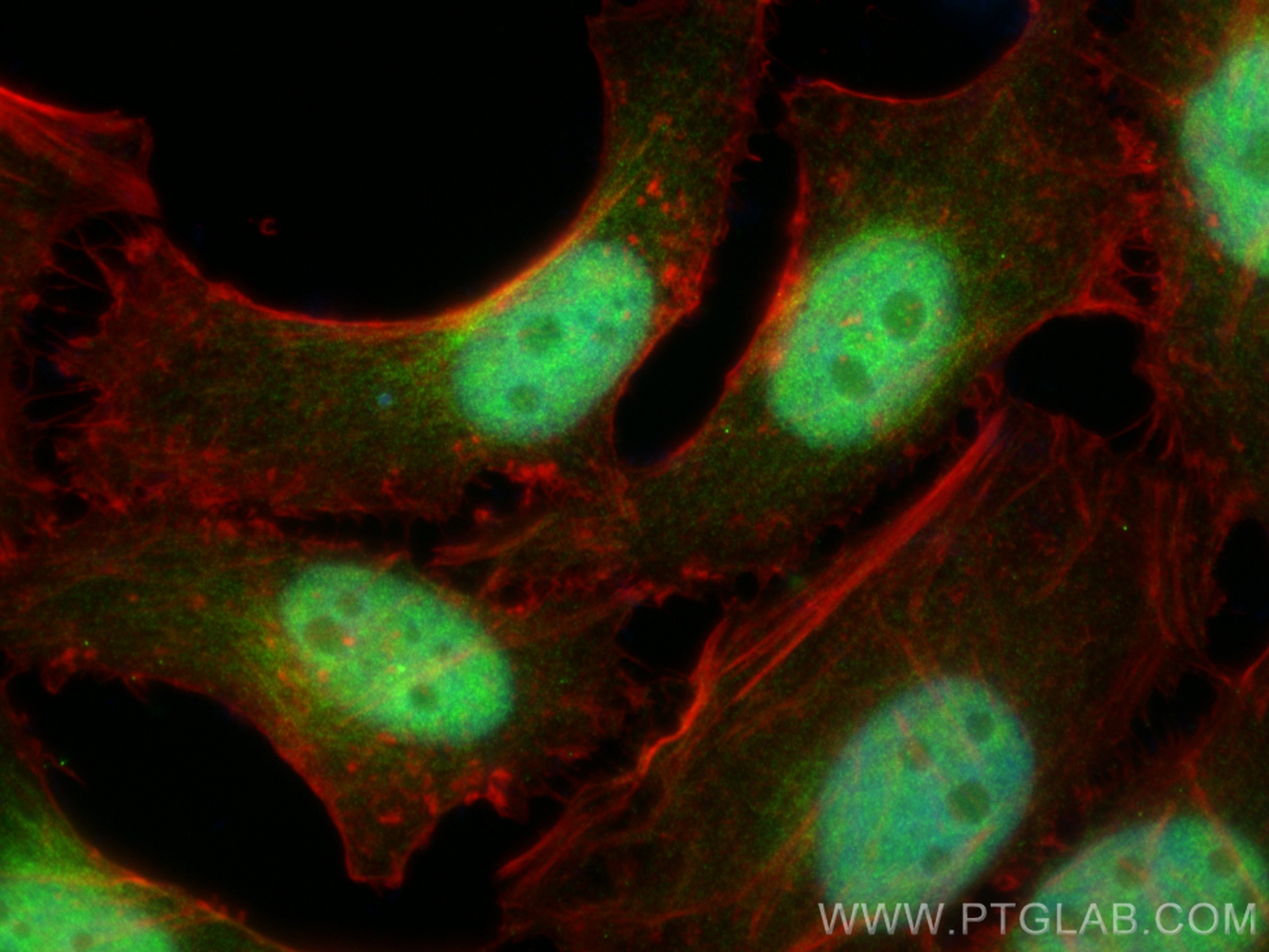 Immunofluorescence (IF) / fluorescent staining of HeLa cells using CUTC Polyclonal antibody (15030-1-AP)