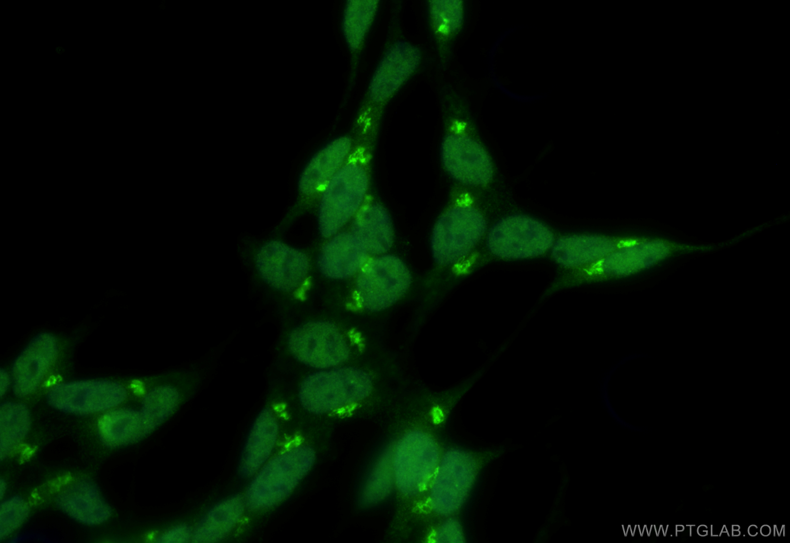 Immunofluorescence (IF) / fluorescent staining of SH-SY5Y cells using CUX1 Polyclonal antibody (11733-1-AP)