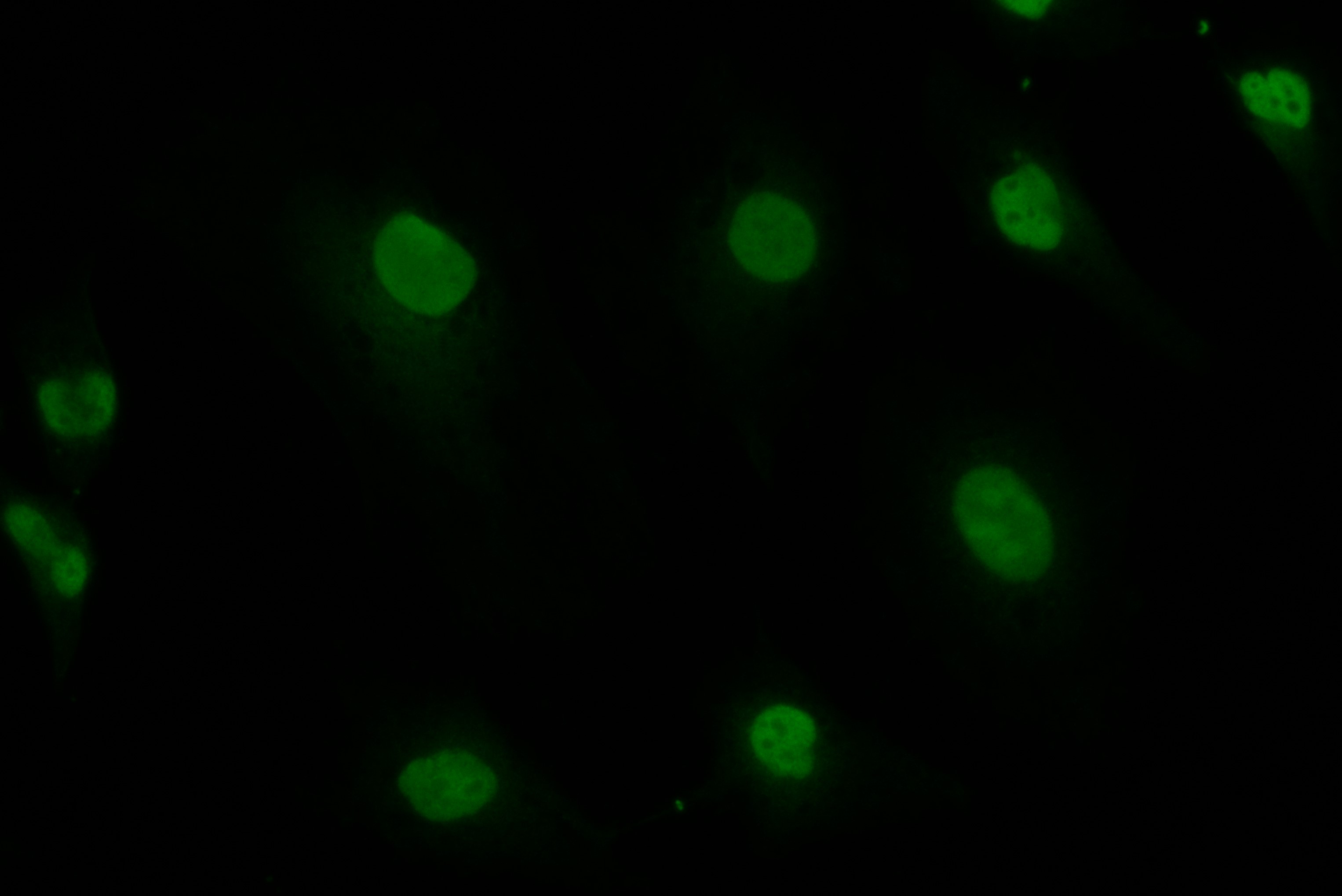 Immunofluorescence (IF) / fluorescent staining of HeLa cells using CUX2 Recombinant antibody (82933-1-RR)