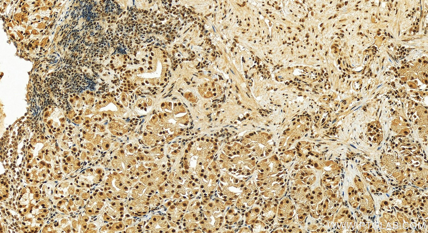 Immunohistochemistry (IHC) staining of human stomach tissue using CWC15 Polyclonal antibody (25293-1-AP)