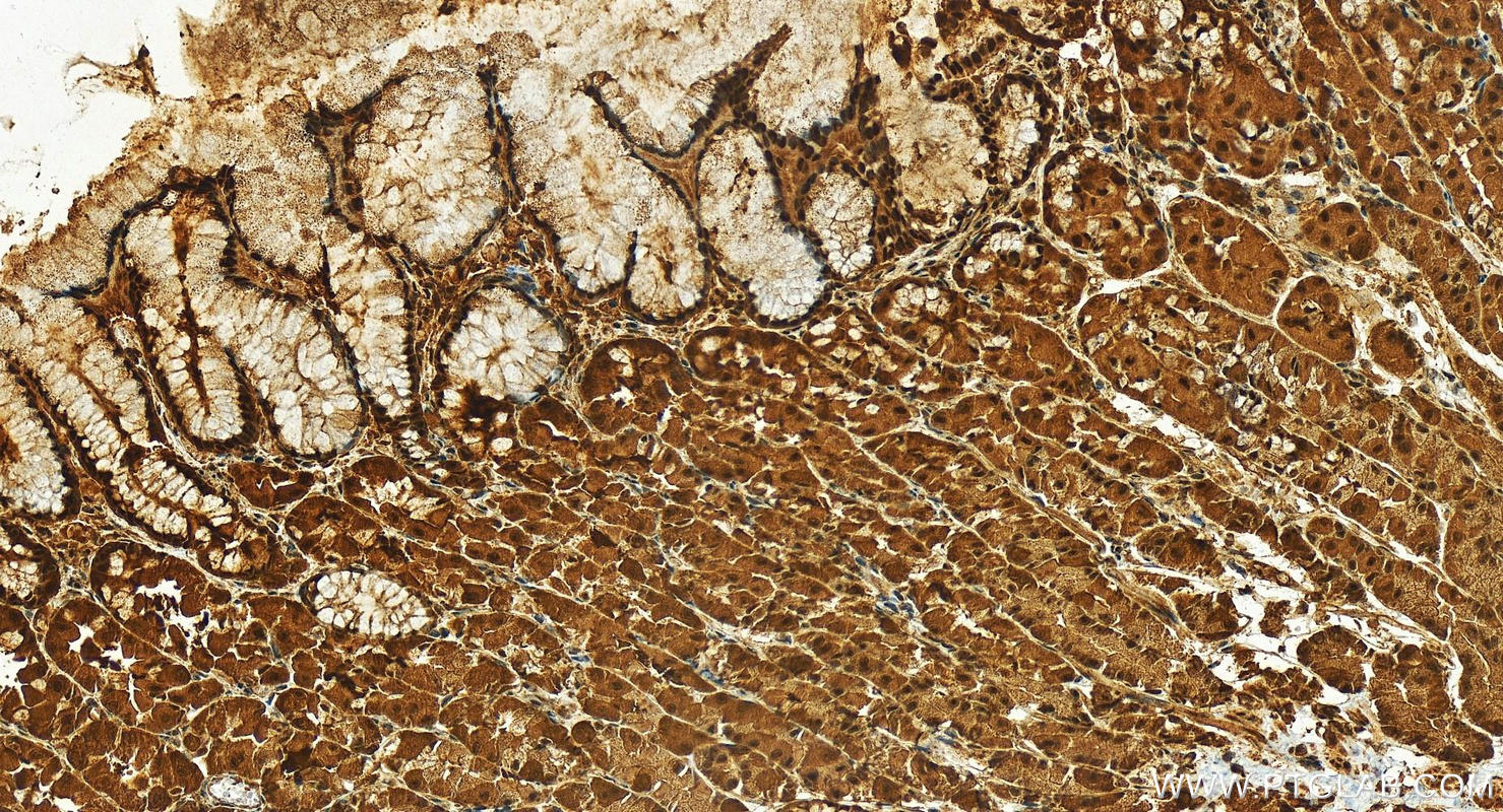 Immunohistochemistry (IHC) staining of human stomach tissue using CWC22 Polyclonal antibody (26898-1-AP)