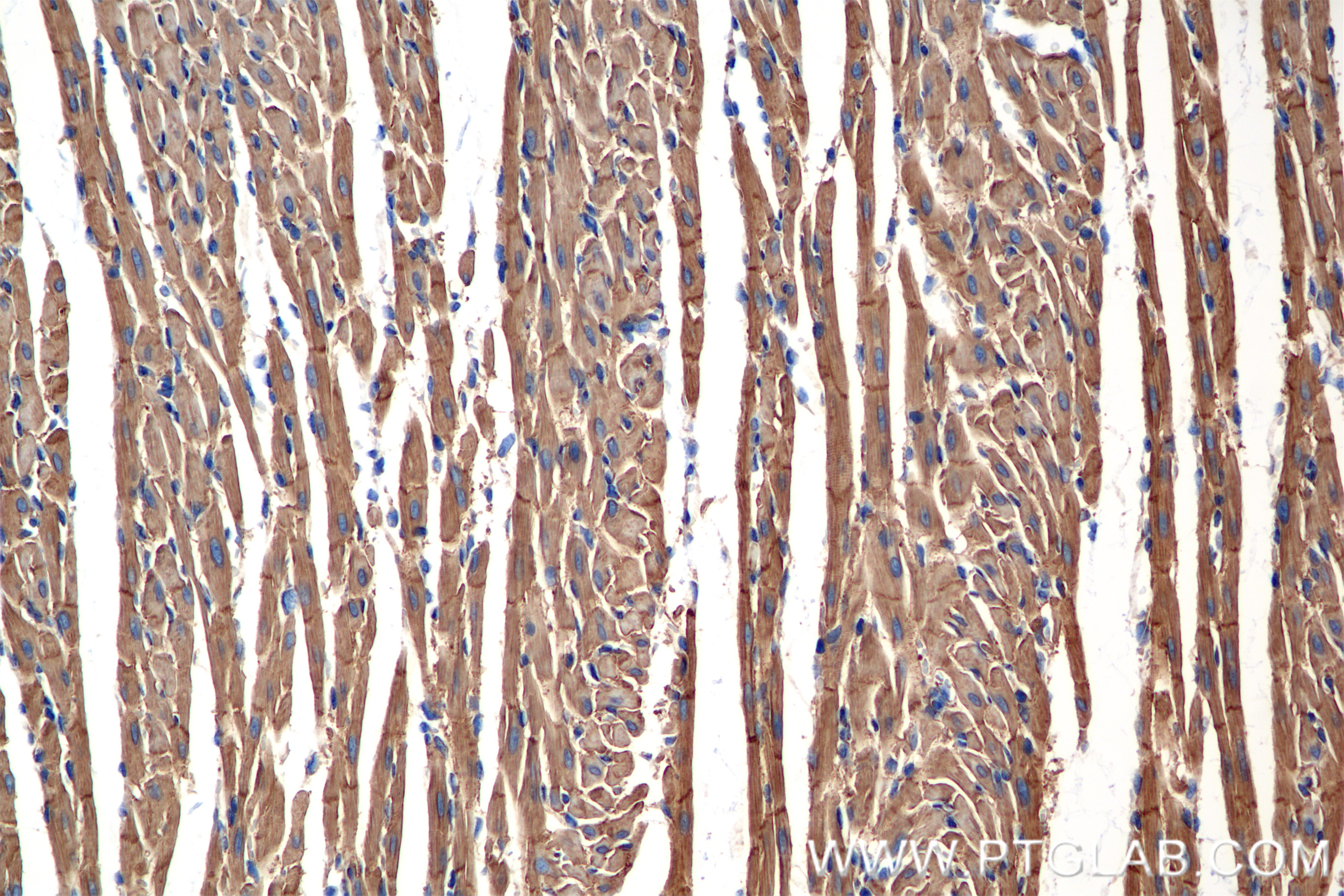 Immunohistochemistry (IHC) staining of rat heart tissue using CXADR Recombinant antibody (86186-1-RR)