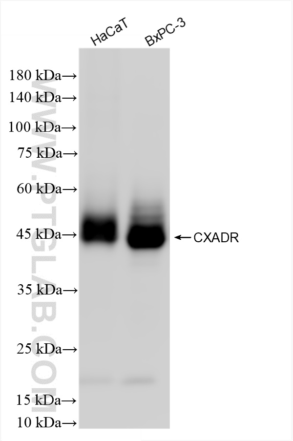 Western Blot (WB) analysis of various lysates using CXADR Recombinant antibody (86186-1-RR)