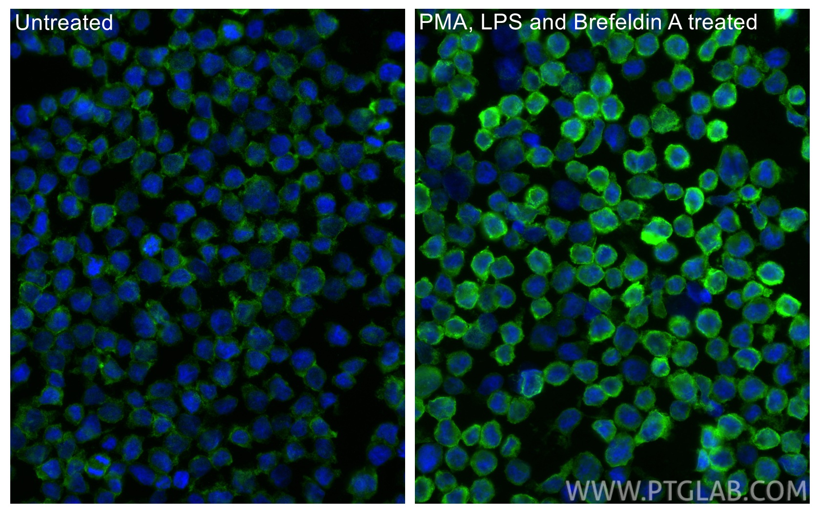 Immunofluorescence (IF) / fluorescent staining of THP-1 cells using CXCL8/IL-8 Polyclonal antibody (27095-1-AP)