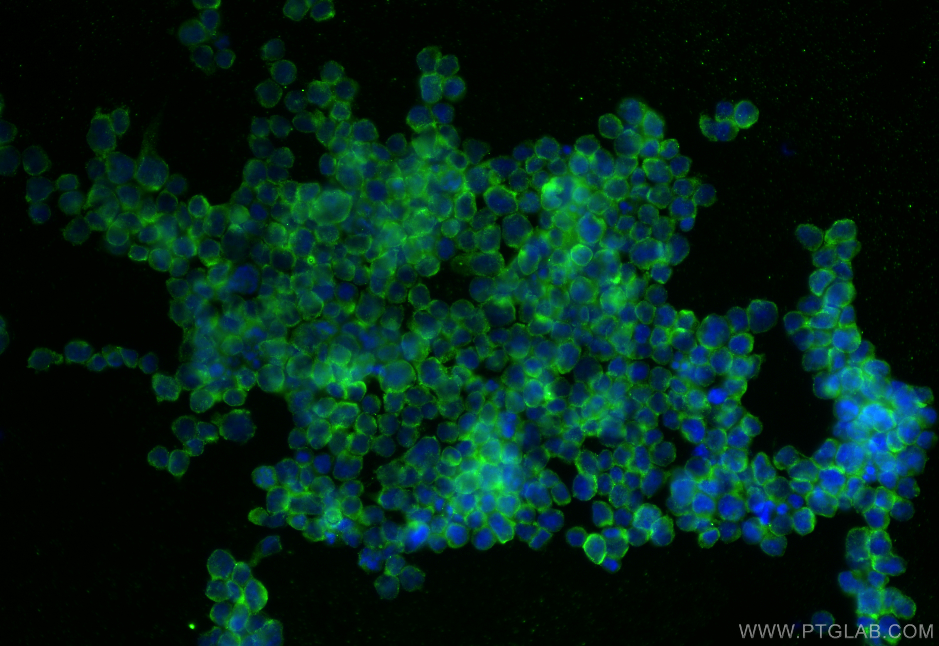 Immunofluorescence (IF) / fluorescent staining of Jurkat cells using CXCR1 Polyclonal antibody (55450-1-AP)