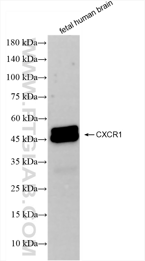 Western Blot (WB) analysis of fetal human brain tissue using CXCR1 Recombinant antibody (83801-4-RR)