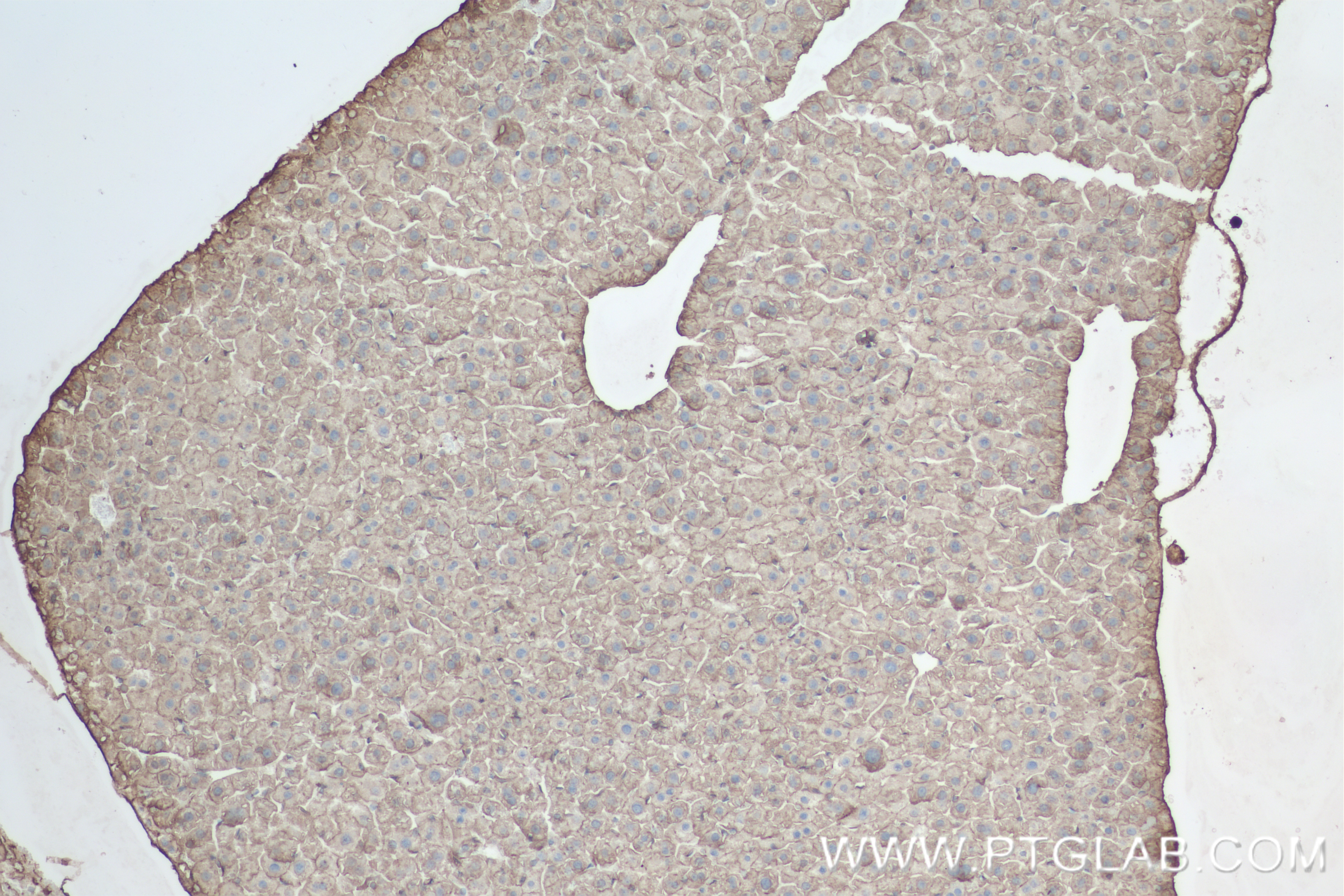 Immunohistochemistry (IHC) staining of mouse liver tissue using CXCR3 Recombinant antibody (84655-5-RR)