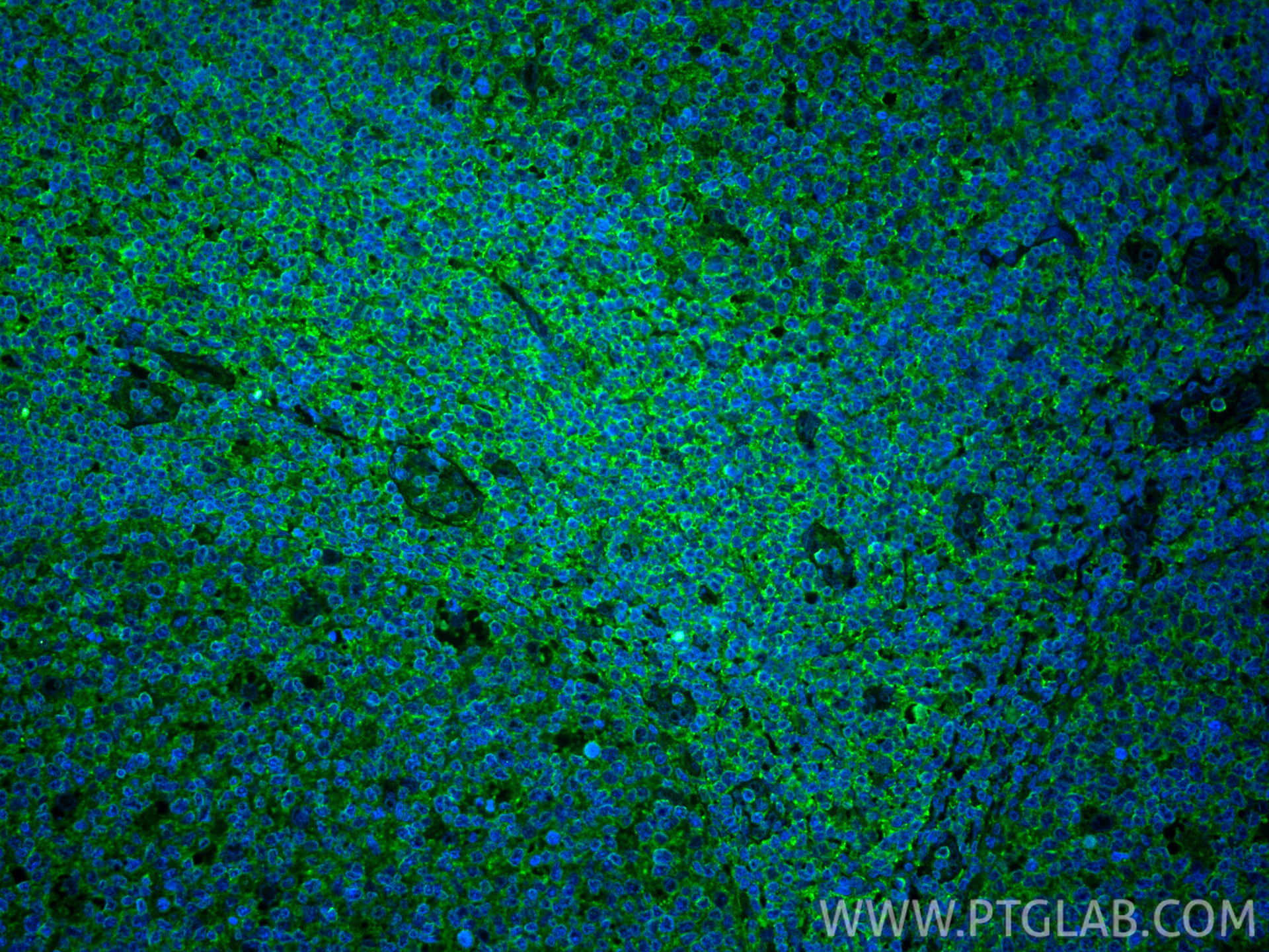 Immunofluorescence (IF) / fluorescent staining of human tonsillitis tissue using CXCR3B-specific Monoclonal antibody (60065-1-Ig)