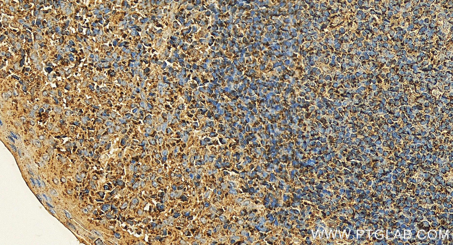 Immunohistochemistry (IHC) staining of human tonsillitis tissue using CXCR4 Monoclonal antibody (60042-1-Ig)