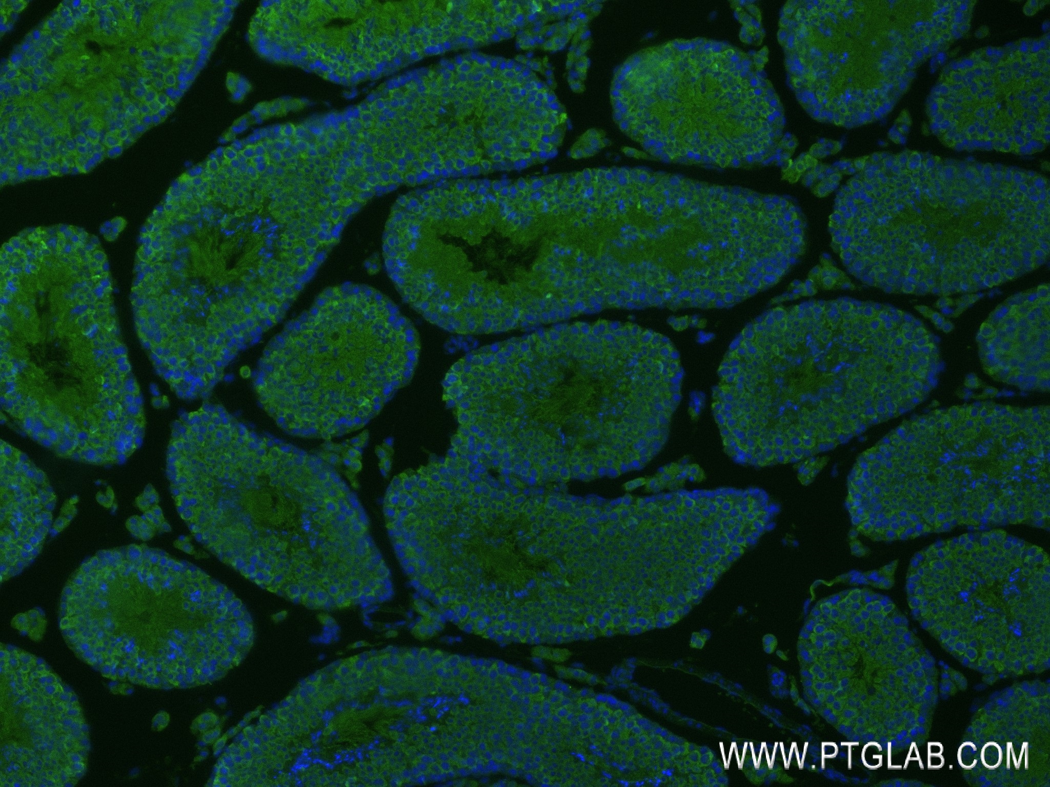 Immunofluorescence (IF) / fluorescent staining of mouse testis tissue using CXCR4 Recombinant antibody (84904-1-RR)