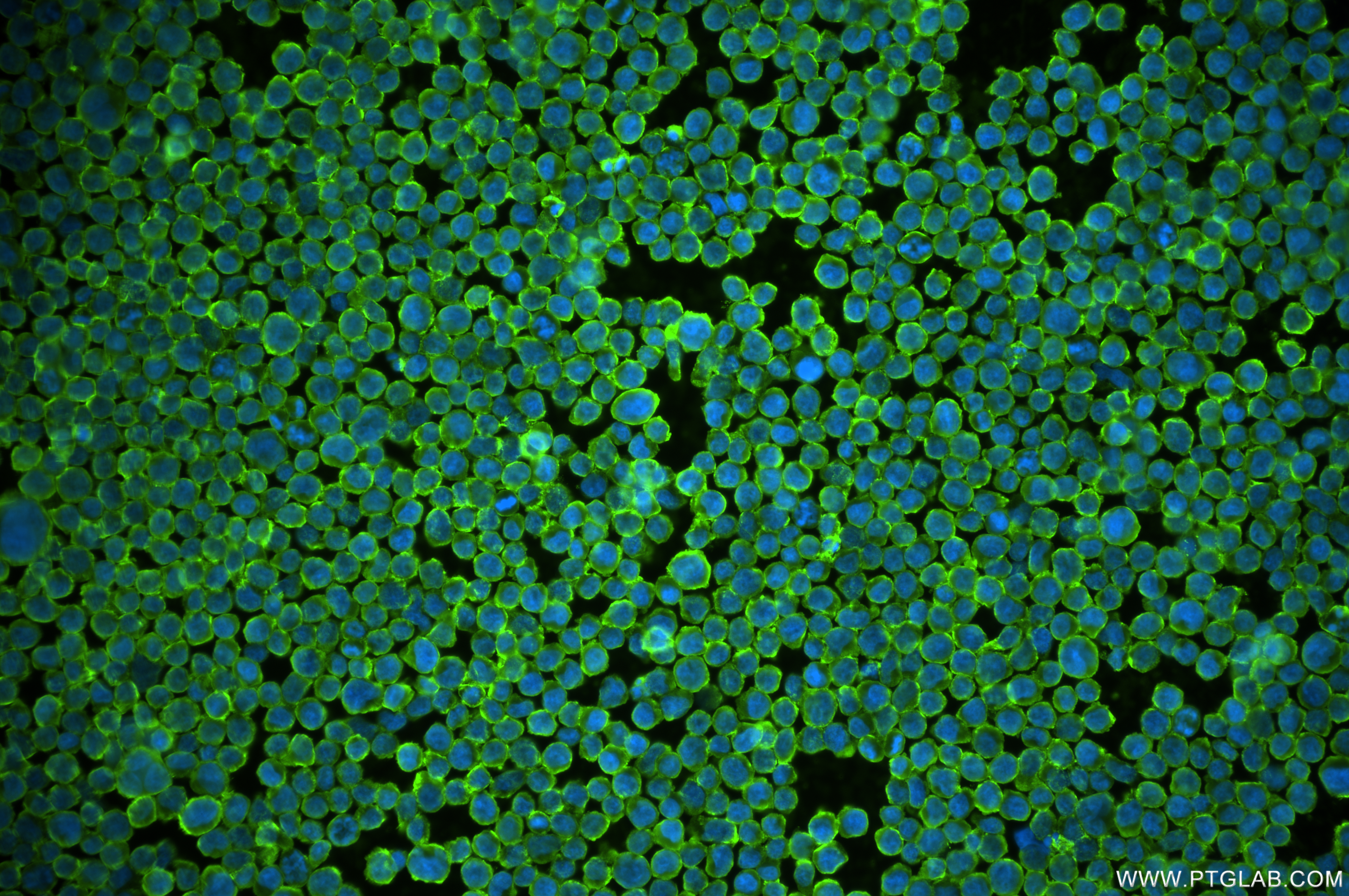 Immunofluorescence (IF) / fluorescent staining of Jurkat cells using CXCR4 Recombinant antibody (84904-1-RR)