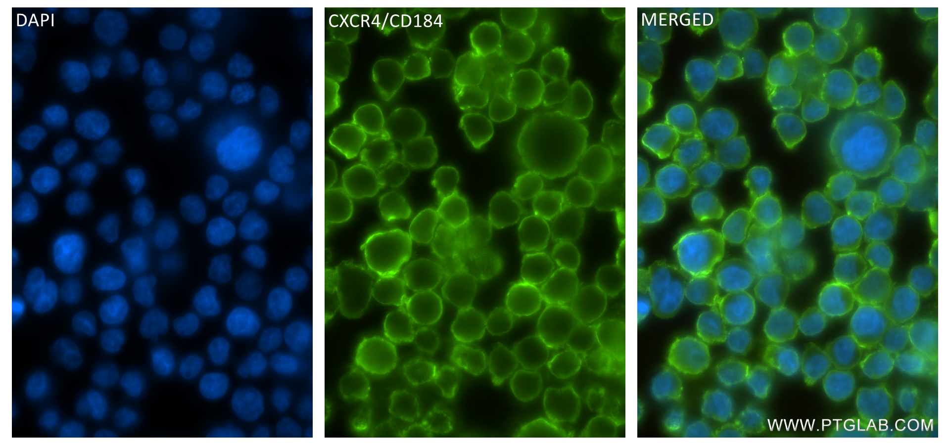 Immunofluorescence (IF) / fluorescent staining of Jurkat cells using CXCR4 Recombinant antibody (84904-1-RR)