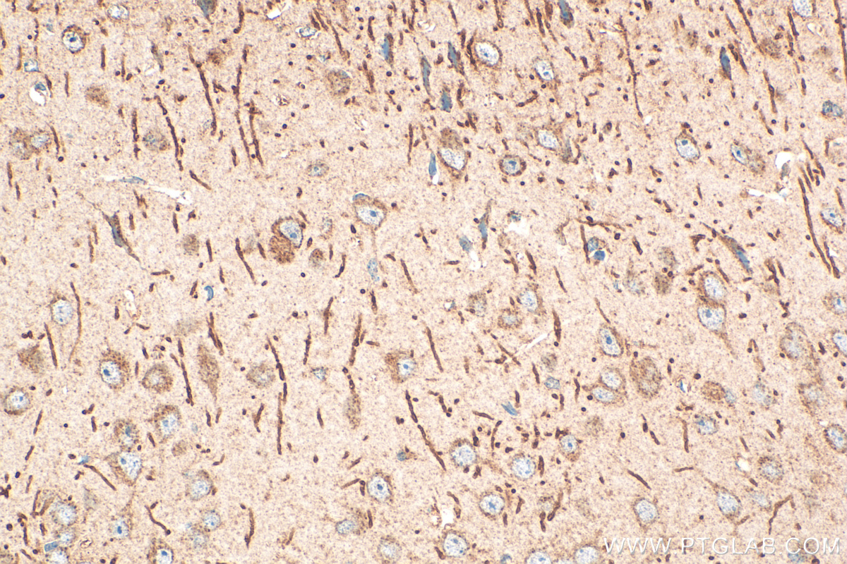 Immunohistochemistry (IHC) staining of mouse brain tissue using CXCR5 Polyclonal antibody (28239-1-AP)