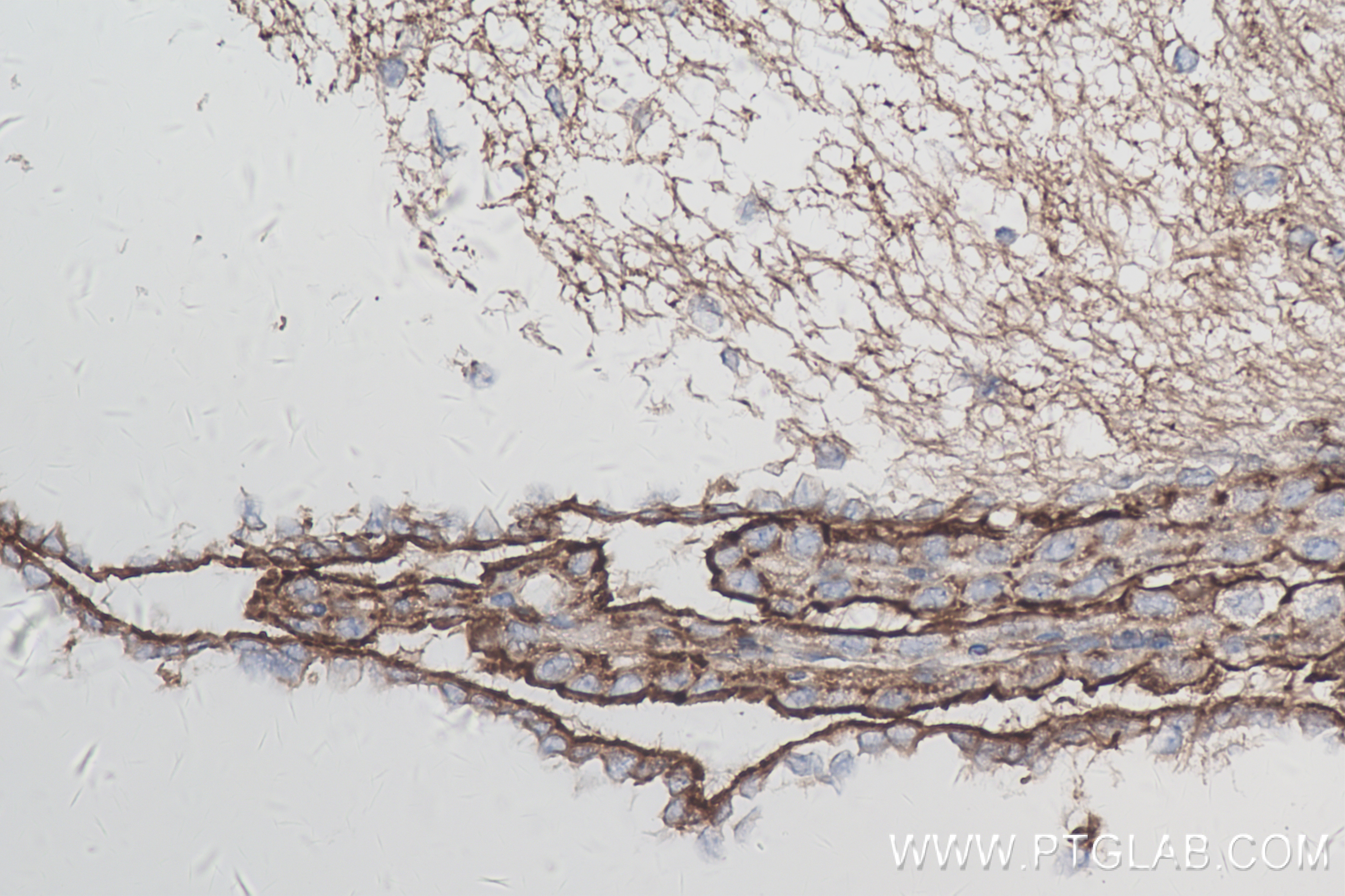 Immunohistochemistry (IHC) staining of mouse brain tissue using CXCR6 Recombinant antibody (84591-1-RR)