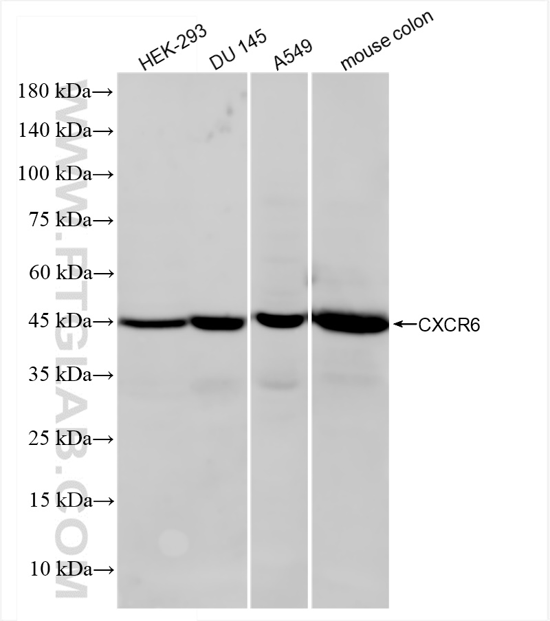 CXCR6