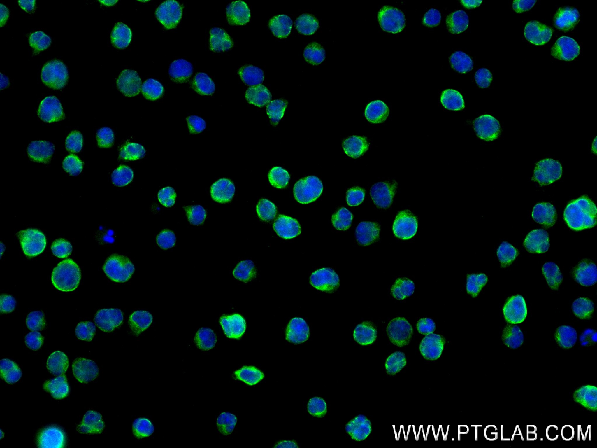 Immunofluorescence (IF) / fluorescent staining of Jurkat cells using CXCR7 Recombinant antibody (83927-1-RR)