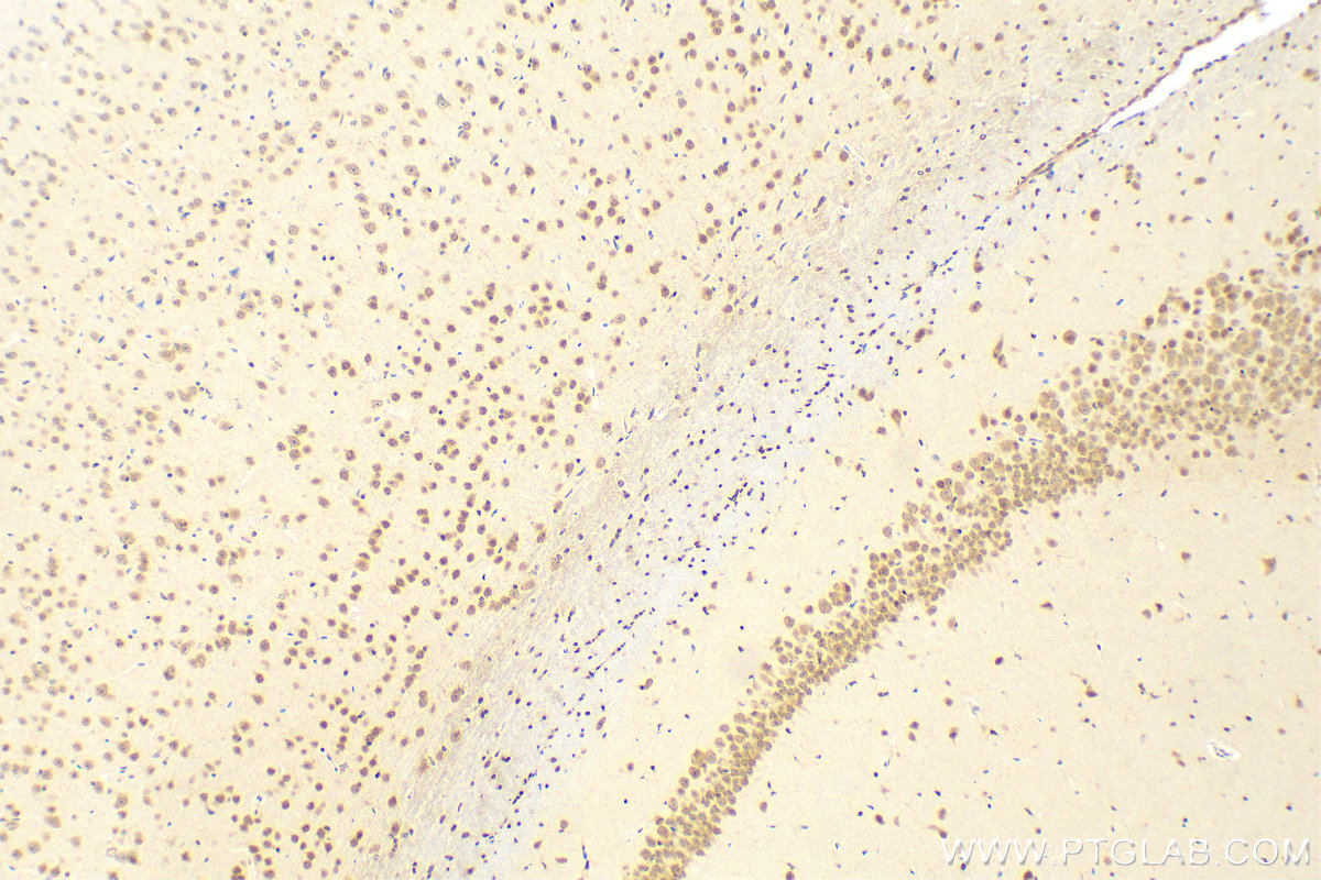 Immunohistochemistry (IHC) staining of mouse brain tissue using CXXC5 Polyclonal antibody (16513-1-AP)