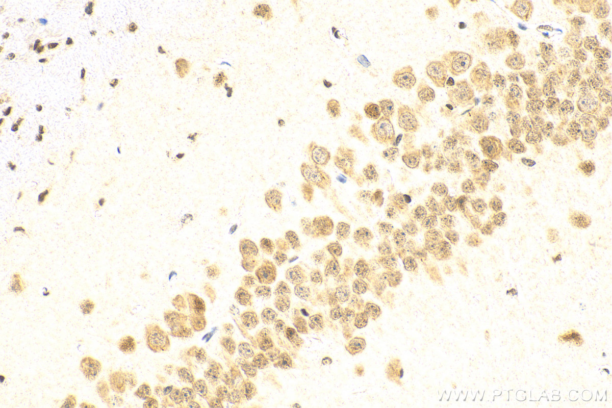 Immunohistochemistry (IHC) staining of mouse brain tissue using CXXC5 Polyclonal antibody (16513-1-AP)