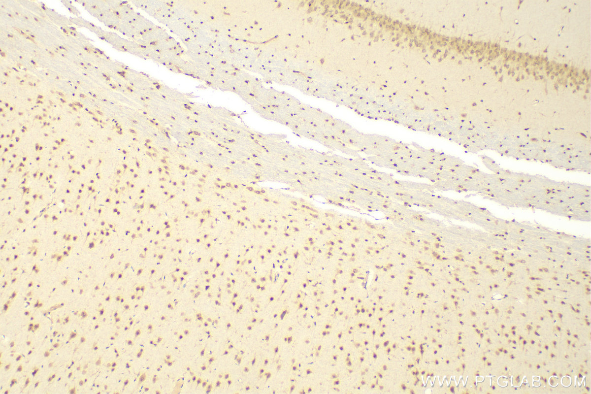 Immunohistochemistry (IHC) staining of rat brain tissue using CXXC5 Polyclonal antibody (16513-1-AP)