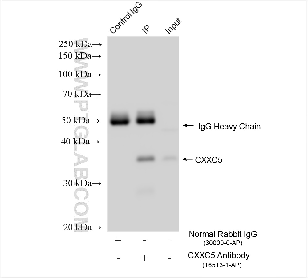 Immunoprecipitation (IP) experiment of SH-SY5Y cells using CXXC5 Polyclonal antibody (16513-1-AP)