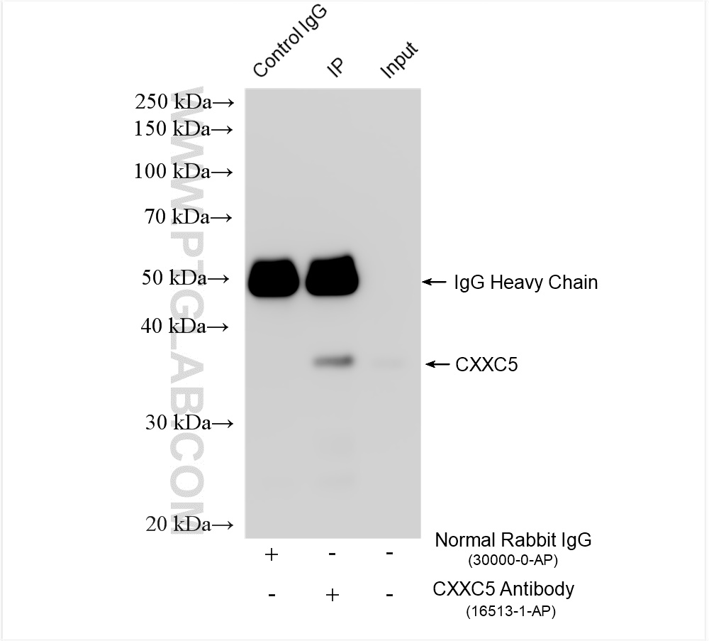 Immunoprecipitation (IP) experiment of mouse brain tissue using CXXC5 Polyclonal antibody (16513-1-AP)