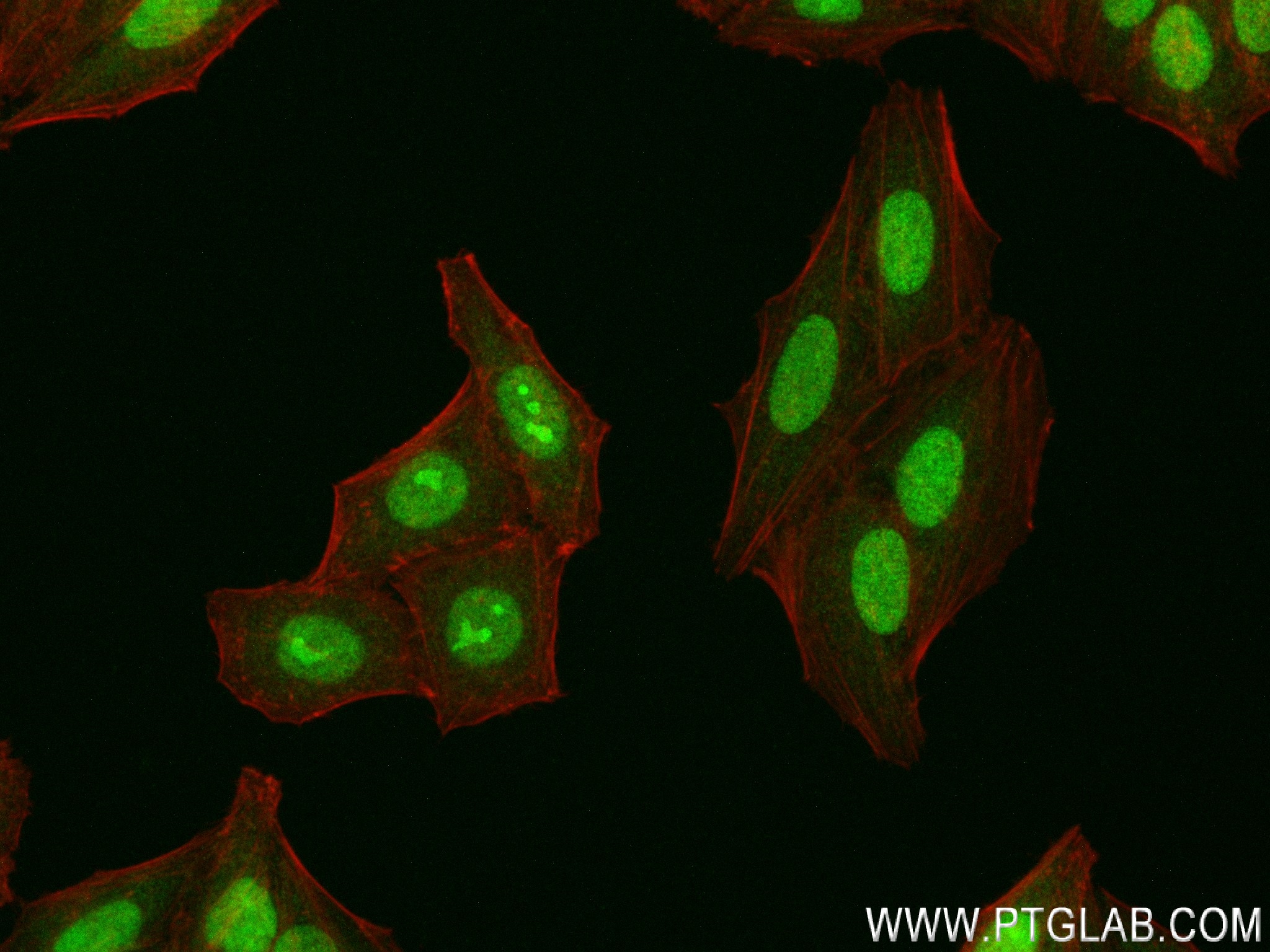 Immunofluorescence (IF) / fluorescent staining of HepG2 cells using CXXC5 Recombinant antibody (83940-6-RR)