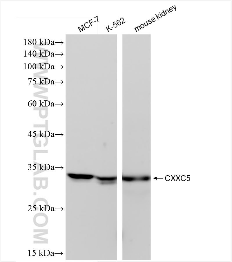 Western Blot (WB) analysis of various lysates using CXXC5 Recombinant antibody (83940-7-RR)