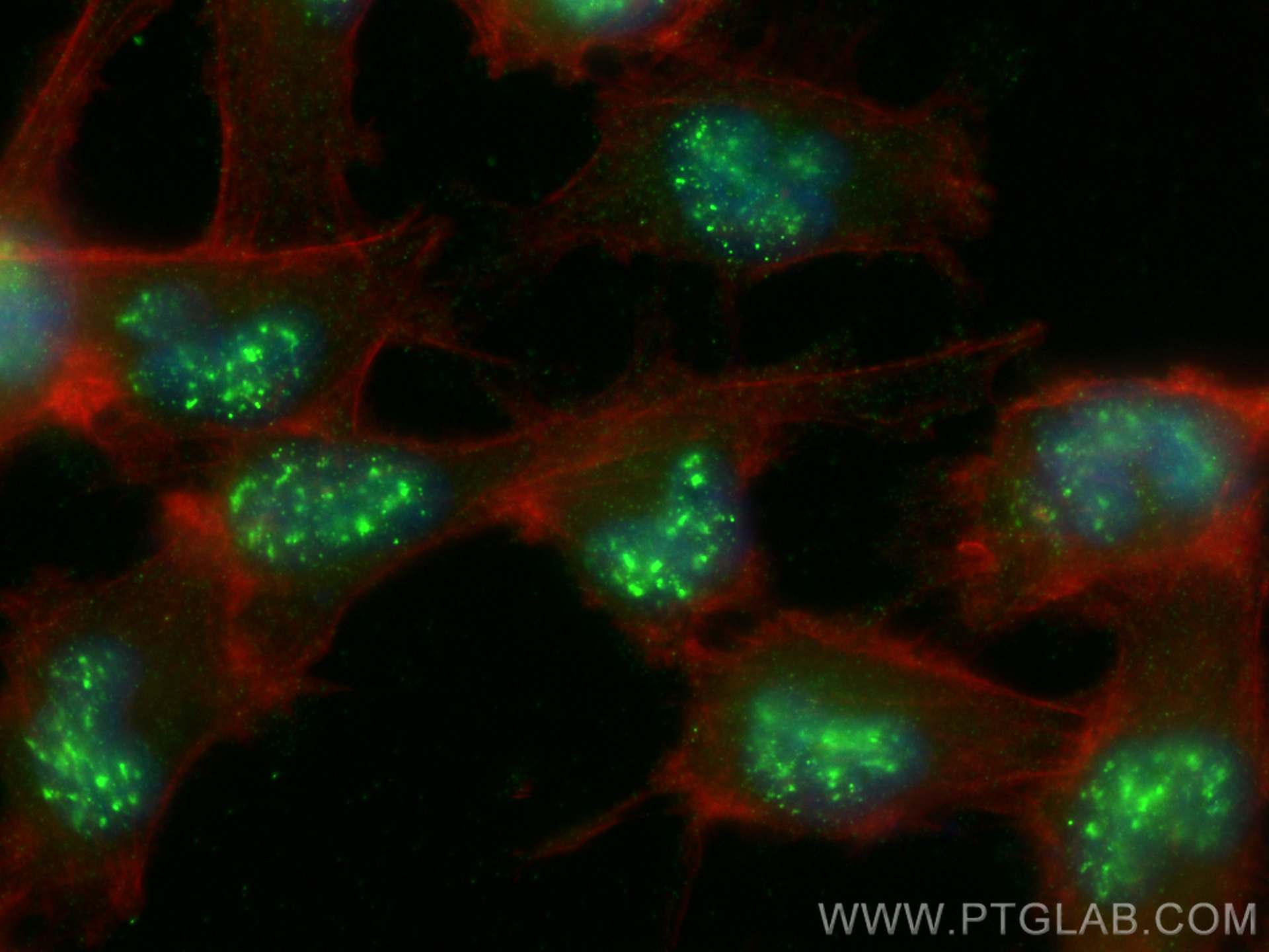 Immunofluorescence (IF) / fluorescent staining of U-251 cells using CXorf21 Polyclonal antibody (30244-1-AP)