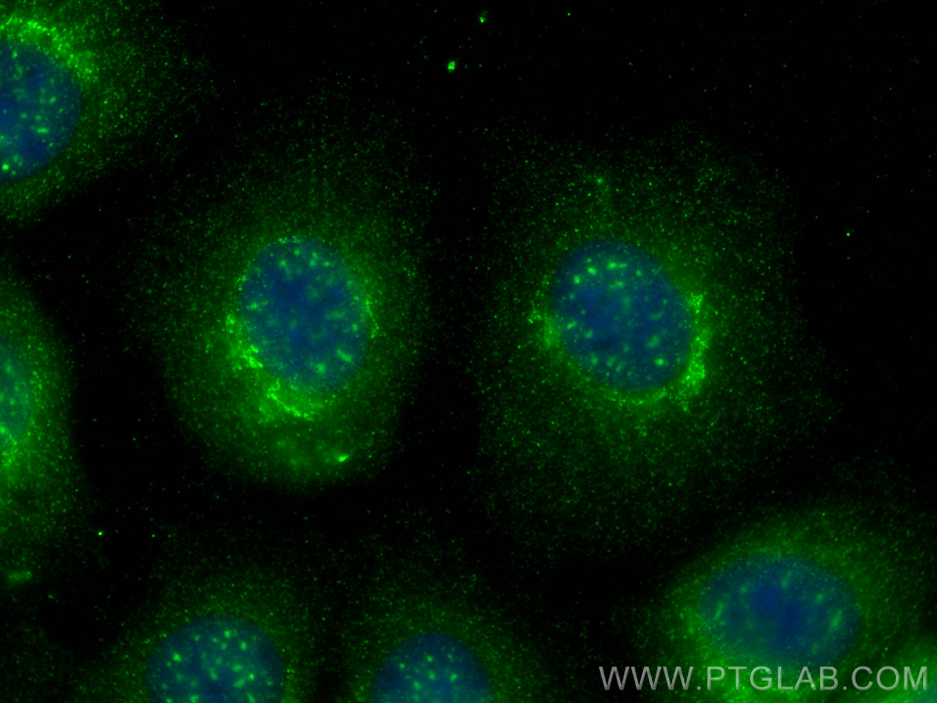 Immunofluorescence (IF) / fluorescent staining of U2OS cells using CXorf21 Polyclonal antibody (30244-1-AP)