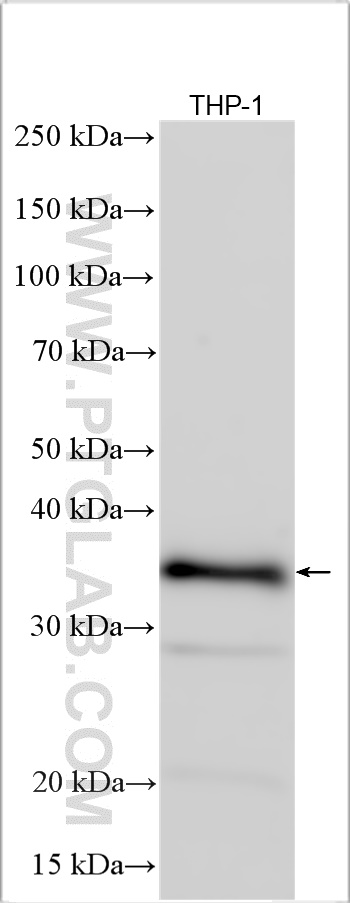 Western Blot (WB) analysis of various lysates using CXorf21 Polyclonal antibody (30244-1-AP)