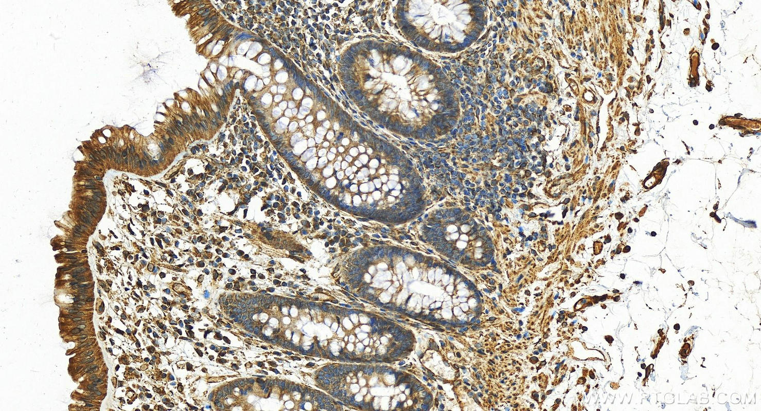 Immunohistochemistry (IHC) staining of human normal colon using CYB5R3 Polyclonal antibody (10894-1-AP)