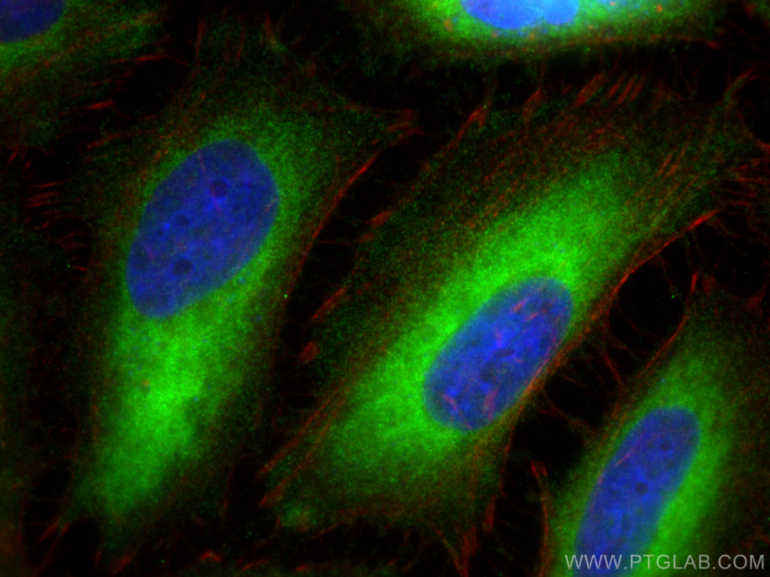 Immunofluorescence (IF) / fluorescent staining of HeLa cells using CYB5R3 Polyclonal antibody (10894-1-AP)