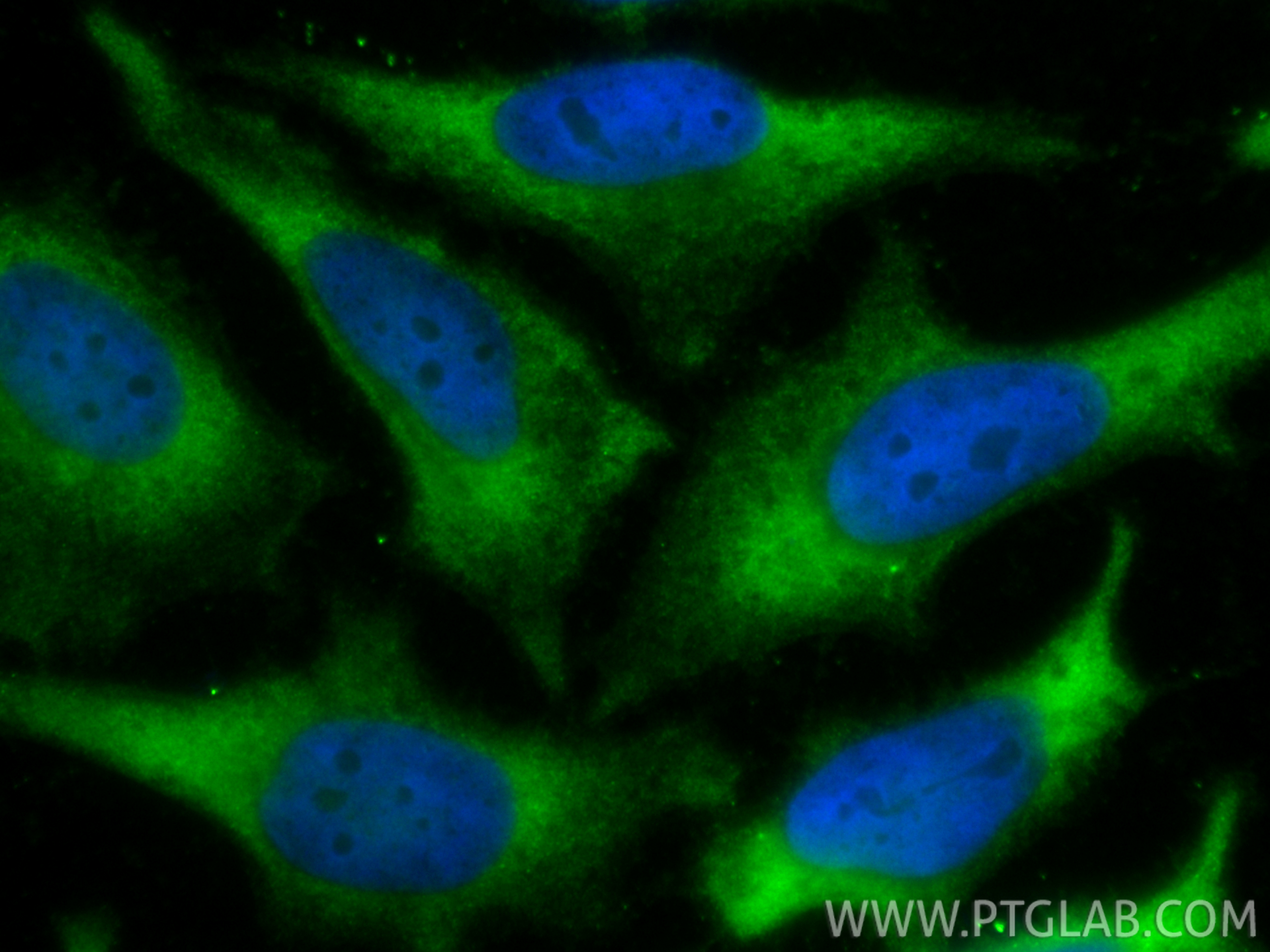 Immunofluorescence (IF) / fluorescent staining of HeLa cells using CoraLite® Plus 488-conjugated CYB5R3 Polyclonal an (CL488-10894)