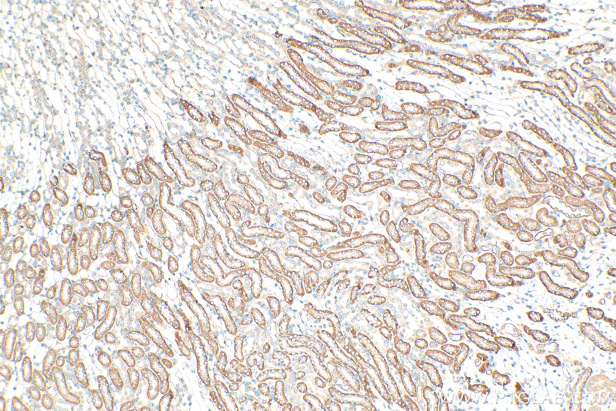 Immunohistochemistry (IHC) staining of mouse kidney tissue using CYB5R4 Polyclonal antibody (12626-1-AP)