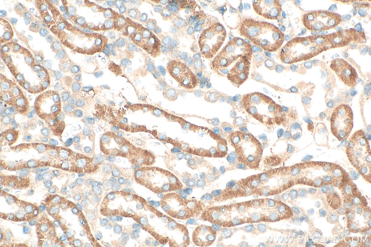 Immunohistochemistry (IHC) staining of mouse kidney tissue using CYB5R4 Polyclonal antibody (12626-1-AP)